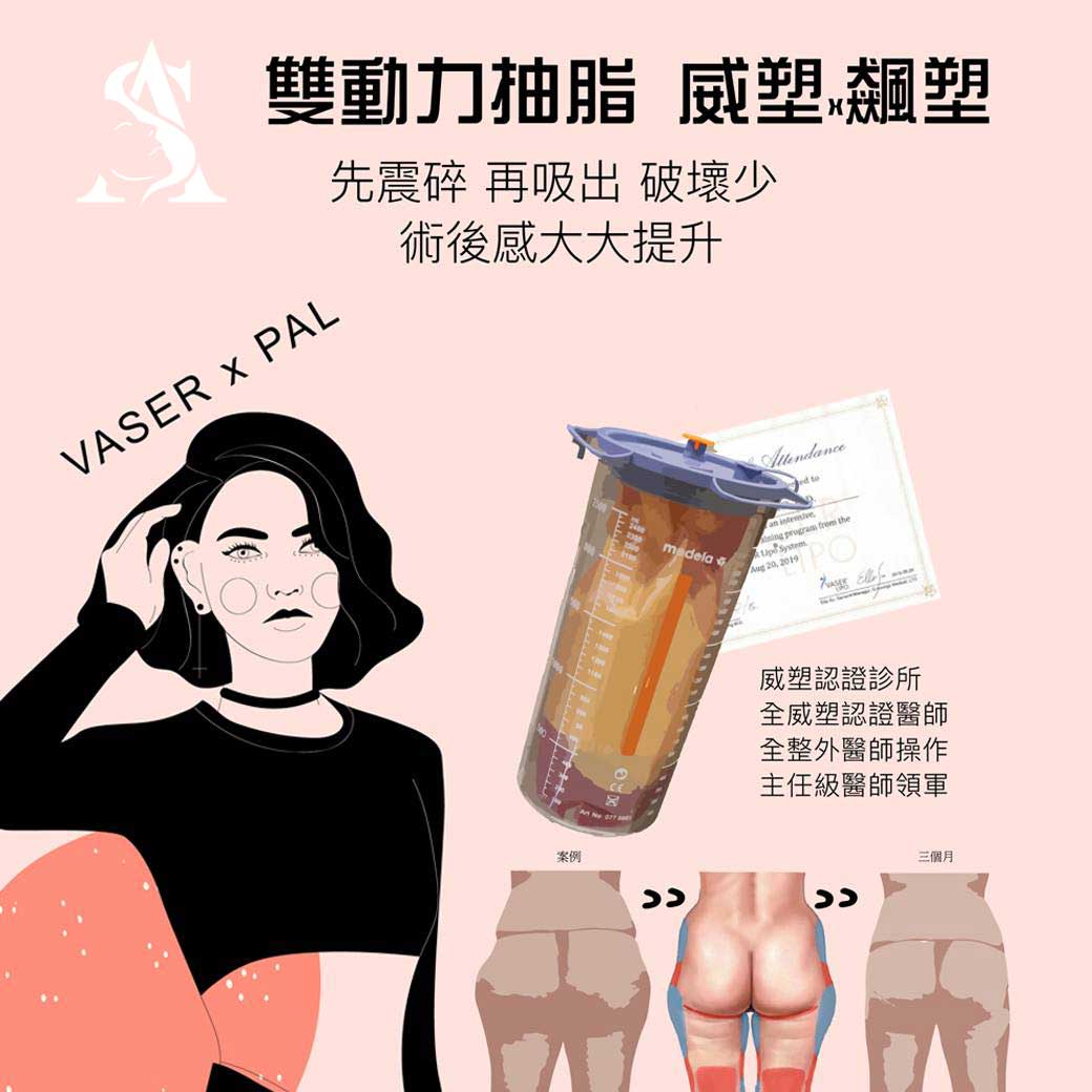 抽脂VS運動？想抽脂一定要了解的