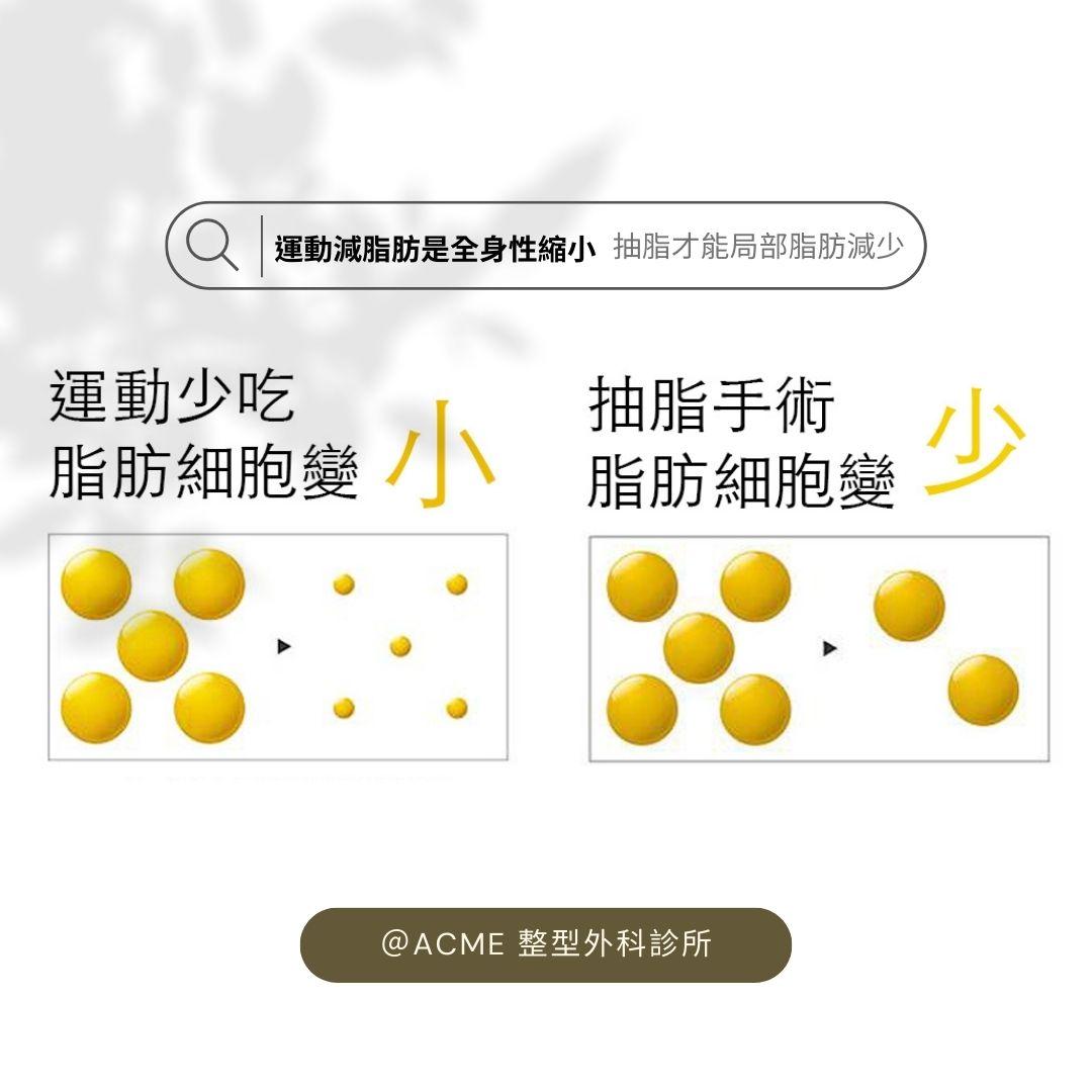 關於抽脂妳想知道的事？