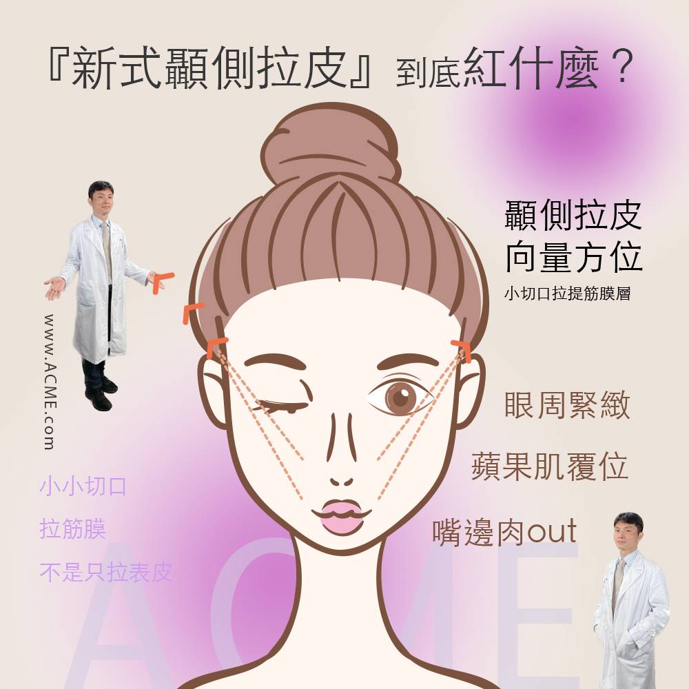 爆紅的顳側拉皮到底是什麼？