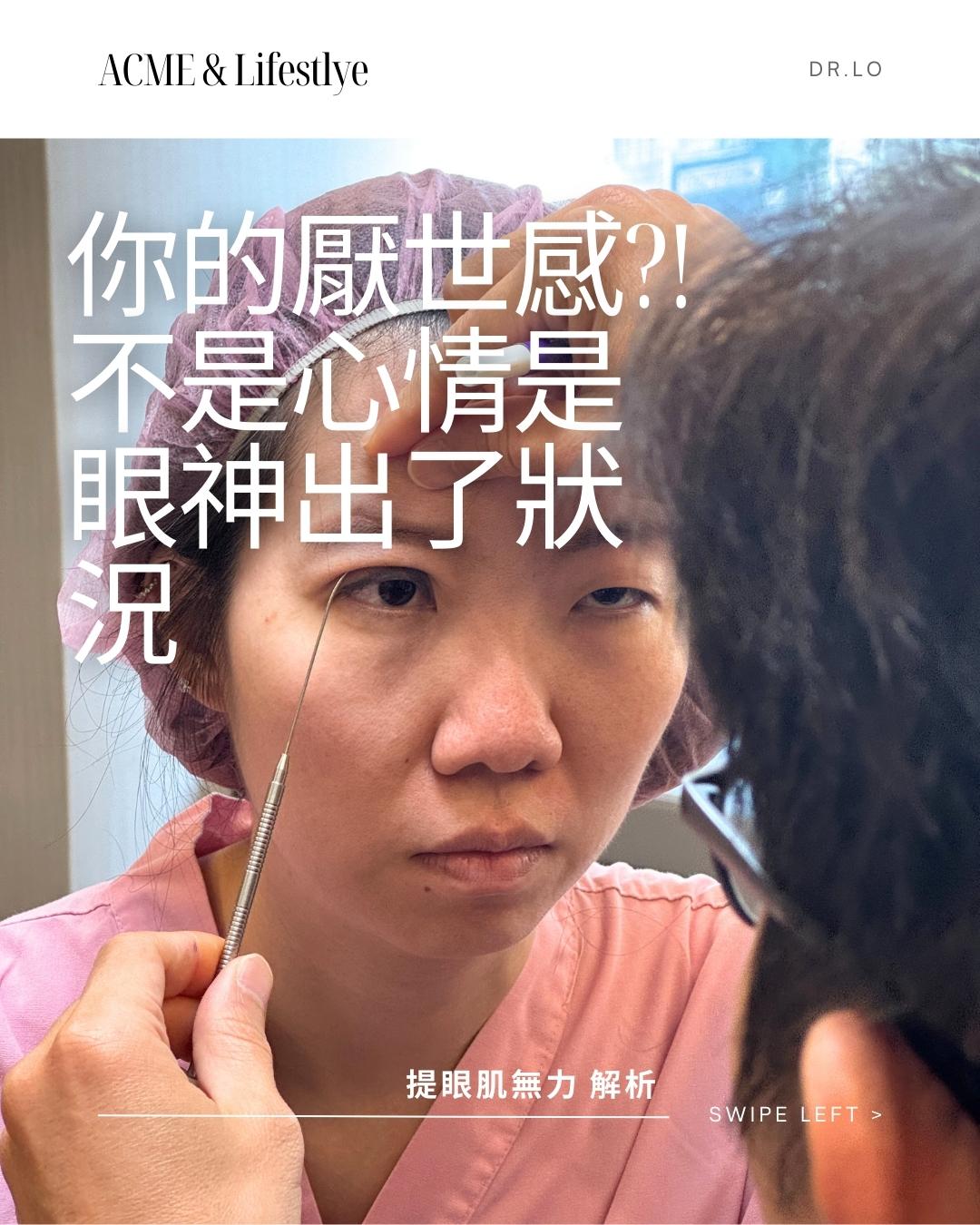 羅國銓醫師｜你不是眼睛小，是提眼肌懶惰了!!